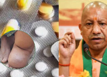 2027 तक फाइलेरिया मुक्त होगा यूपी, योगी सरकार ने 27 जिलों में चलाया MDA अभियान