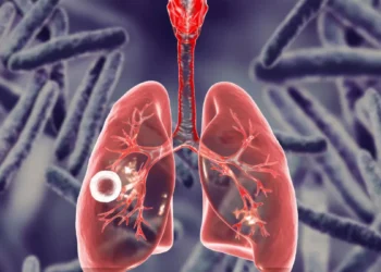 योगी सरकार का टीबी मुक्त प्रदेश की ओर बड़ा कदम